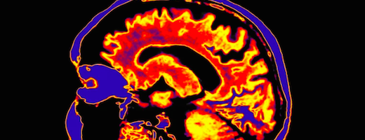 brain-scan-stress-and-tech